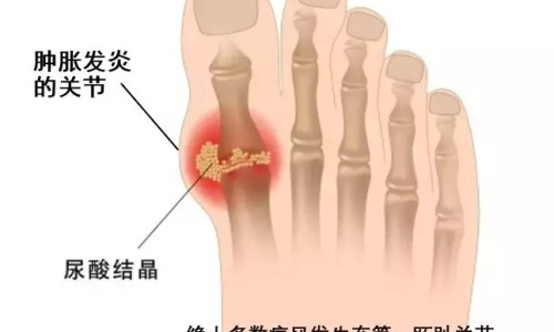 中药治肾虚要多久网中药肾虚一般调理多久知识网站,分享中药治肾虚要多久才能恢复大全